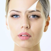180 microdermabrazio2